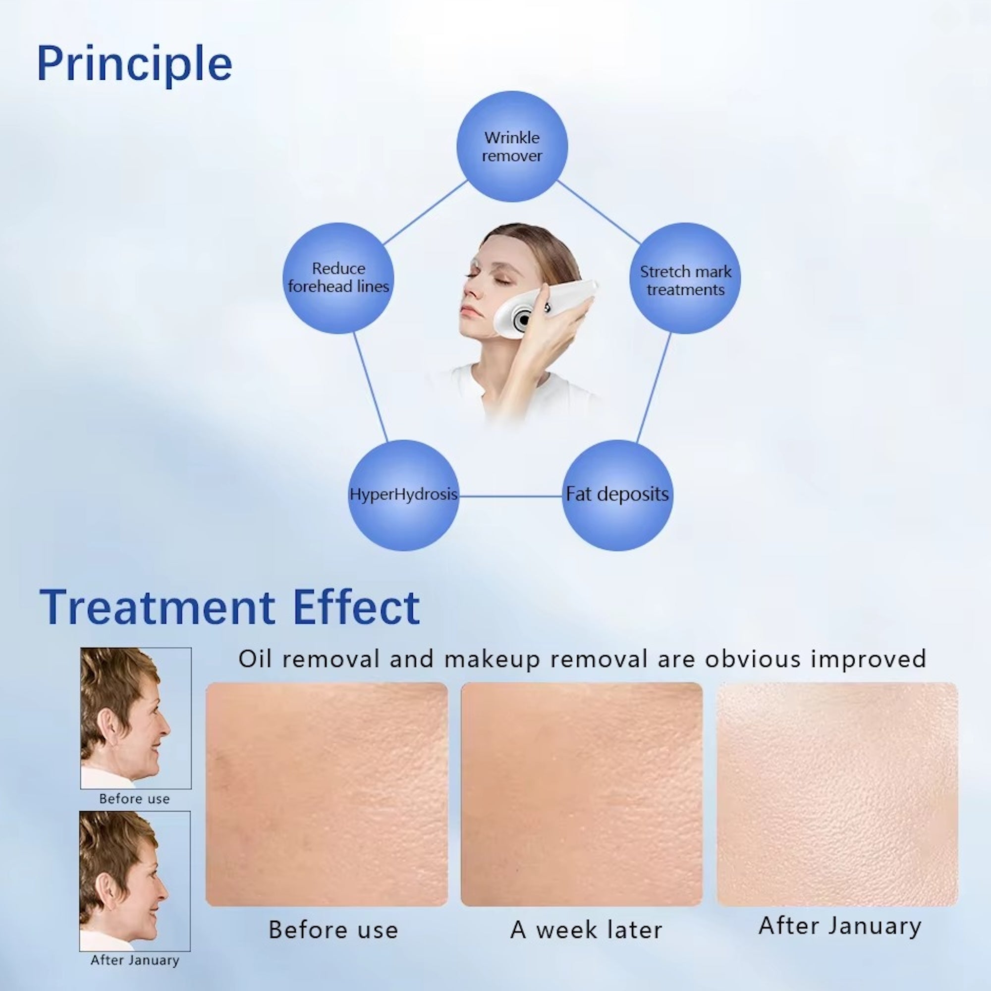 Hot Selling Home Use Effectively Introduce Skin Care EMS Product Guided Dermo Electro Proration Non-Invasive Beauty Machine