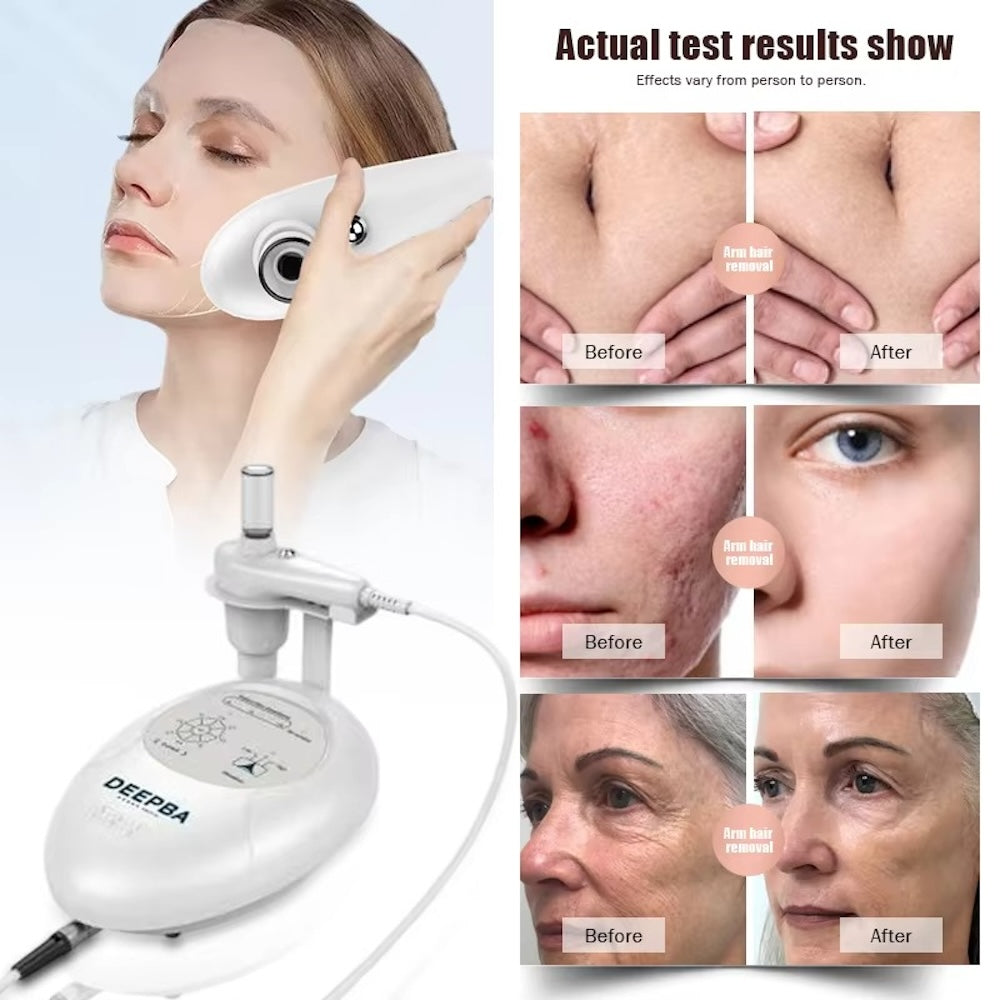 Hot Selling Home Use Effectively Introduce Skin Care EMS Product Guided Dermo Electro Proration Non-Invasive Beauty Machine