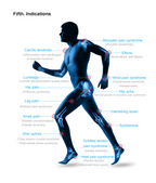 Focus Shockwave Eswt High Intensity Focused Shock Wave Chiropractic Physiotherapy Machine Muscle Bone Pain Relief