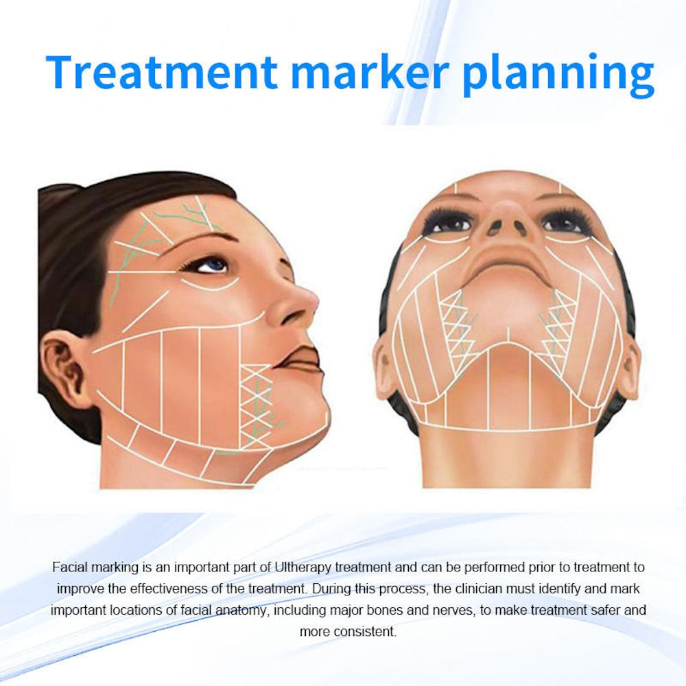 Newest Generation 2.0 Hifu High Frequency Anti-Aging Ultra Sound Therapy Face Body Lifting Device SMAS Wrinkle Removal Machine