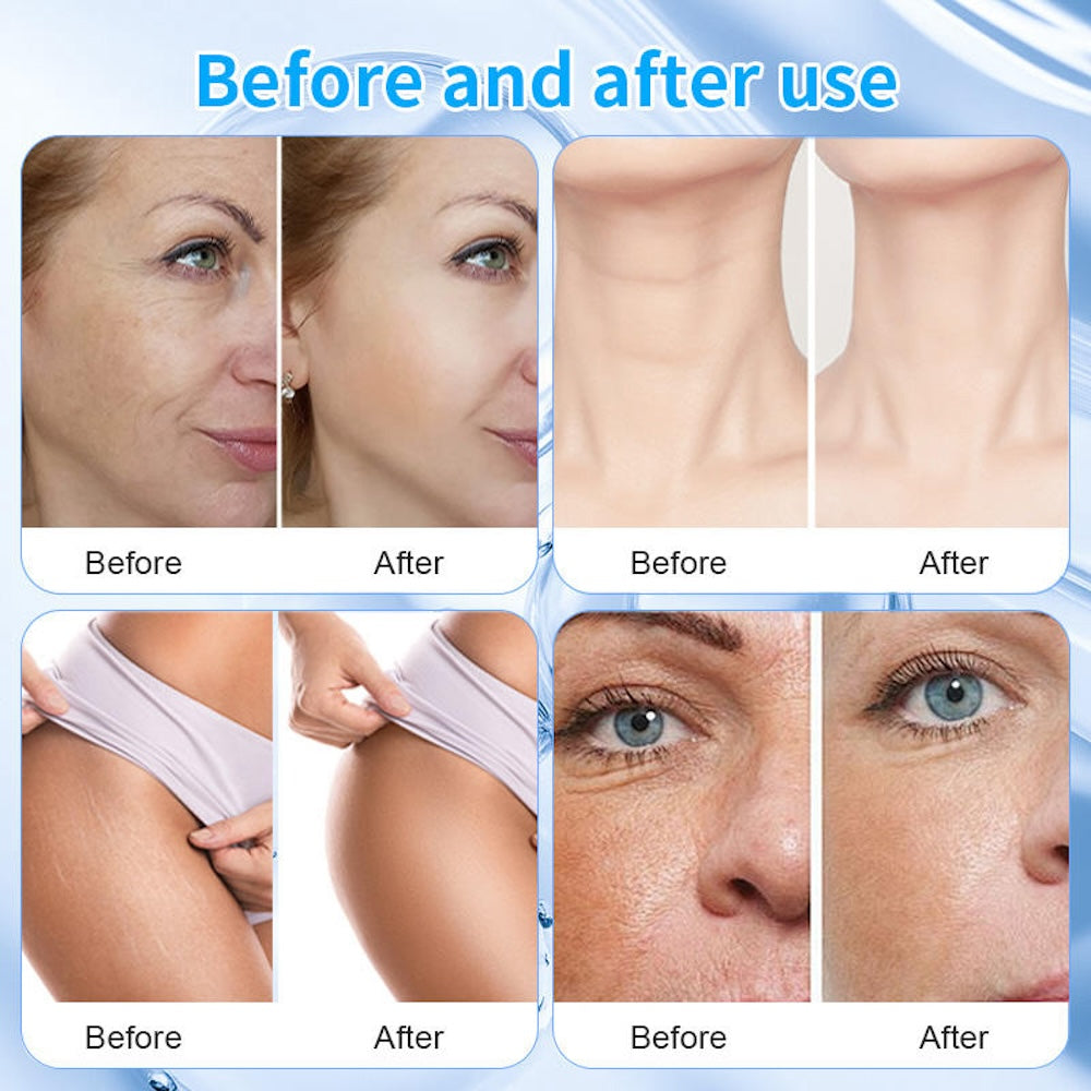 Newest Generation 2.0 Hifu High Frequency Anti-Aging Ultra Sound Therapy Face Body Lifting Device SMAS Wrinkle Removal Machine