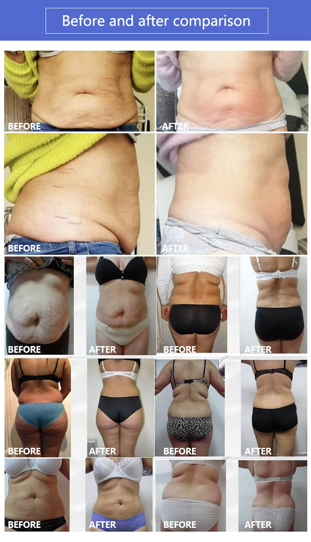 Professional Air Pressure Pressotherapy Machine High Waist Pants for Leg Massage Lymphatic Drainage Suit Weight Loss Device