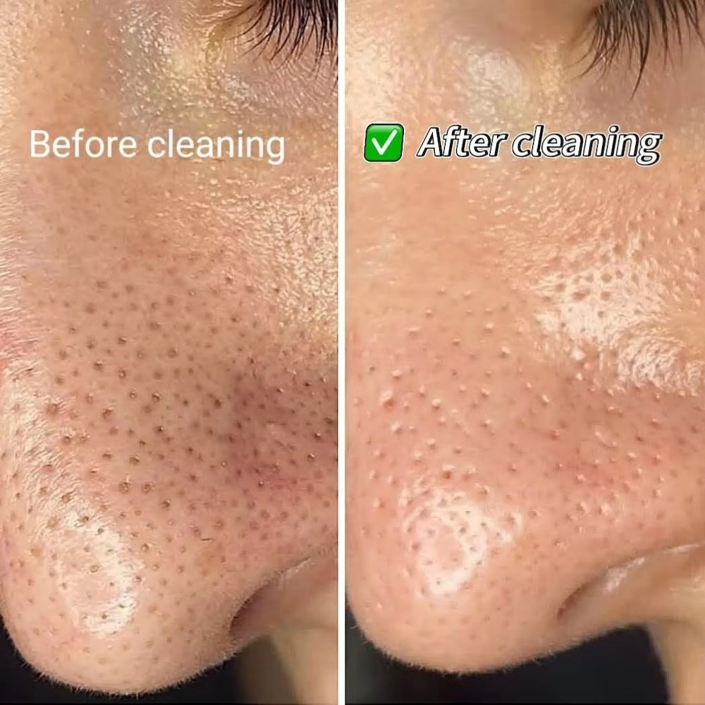 Tips for Multifunction Hydra Facial Aqua Microdermabrasion Oxygen Facial Machine Spa Peeling Tips Hydra Dermabrasion
