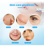 Microdermabrasion Machine for Facial Peel SPA Steam Vacuum Carpet Cleaning Targeting Body Face Eyes Hydro Dermabrasion