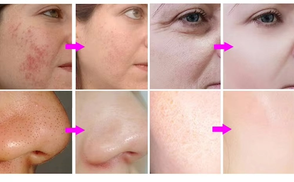 Microdermabrasion Machine for Facial Peel SPA Steam Vacuum Carpet Cleaning Targeting Body Face Eyes Hydro Dermabrasion