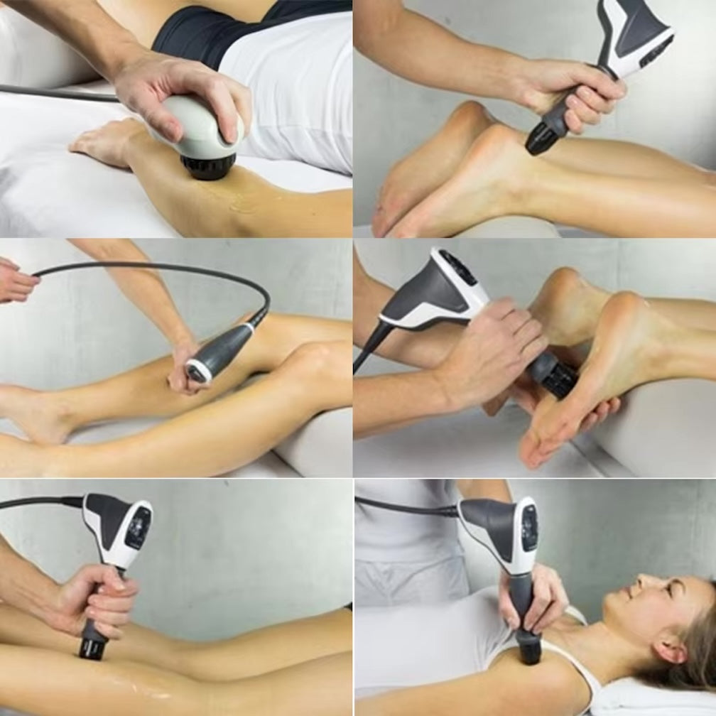 Extracorporeal Medical Radial Shockwave Therapy Machine for Pain Relief ED Treatment
