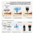 Focus Shockwave Eswt High Intensity Focused Shock Wave Chiropractic Physiotherapy Machine Muscle Bone Pain Relief