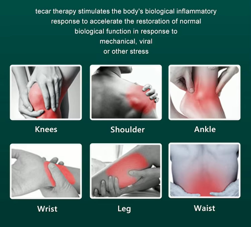 Muscle Pain Relief Tissue Physiotherapy Tecar Cet Ret 448khz Cellulite Removal Slimming Machine